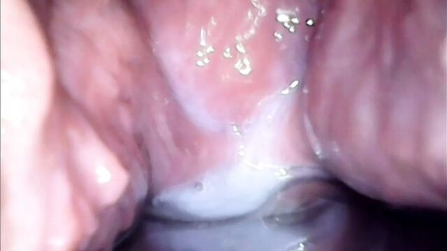 Speculum observation during continuous vaginal creampie