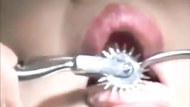 BBW Fetish Dental Visit