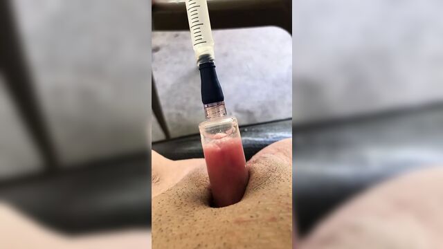 Homemade clit pump & pussy cum