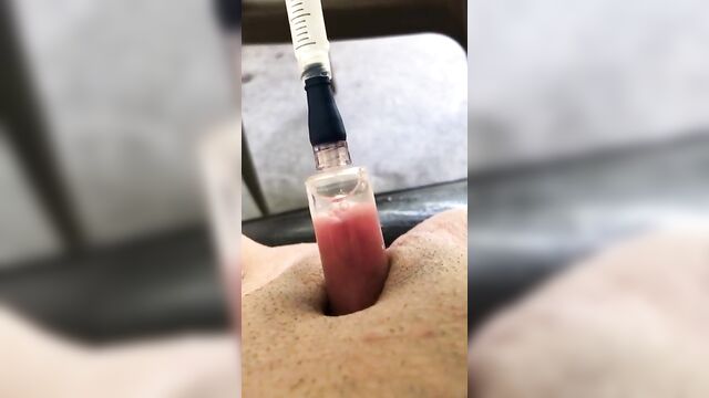 Homemade clit pump & pussy cum