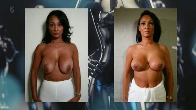 Lisa Maffia - celebrity botched bodies